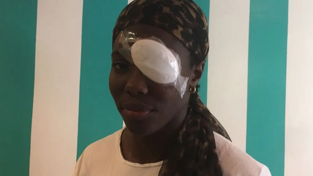 Daisy Osakueová po útoku