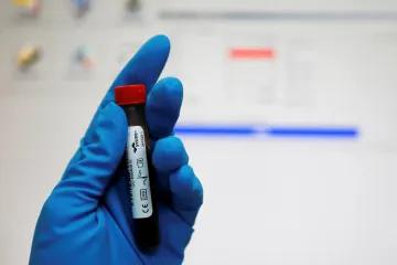 Jeden ze vzorků krevního testu v antidopingové laboratoři v Moskvě