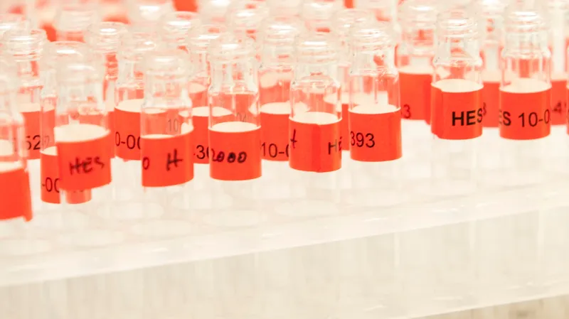 Chlumský o dopingu: Nic zatím nepodnikáme, bude to věc měsíců