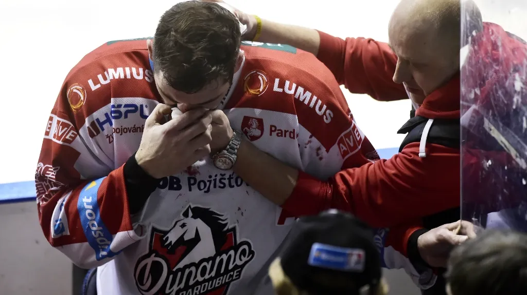 Petr Čáslava se zlomeným nosem