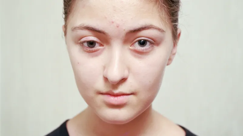 Ilona, Beslan, Severní Osetie, 2011