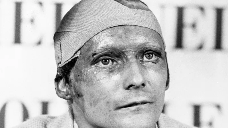 Niki Lauda po nehodě v roce 1976