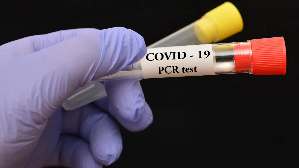 PCR test – ilustrační foto