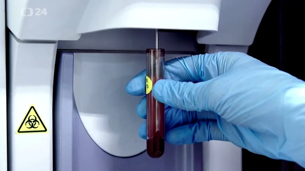 Dopingových kontrol v Česku ubylo