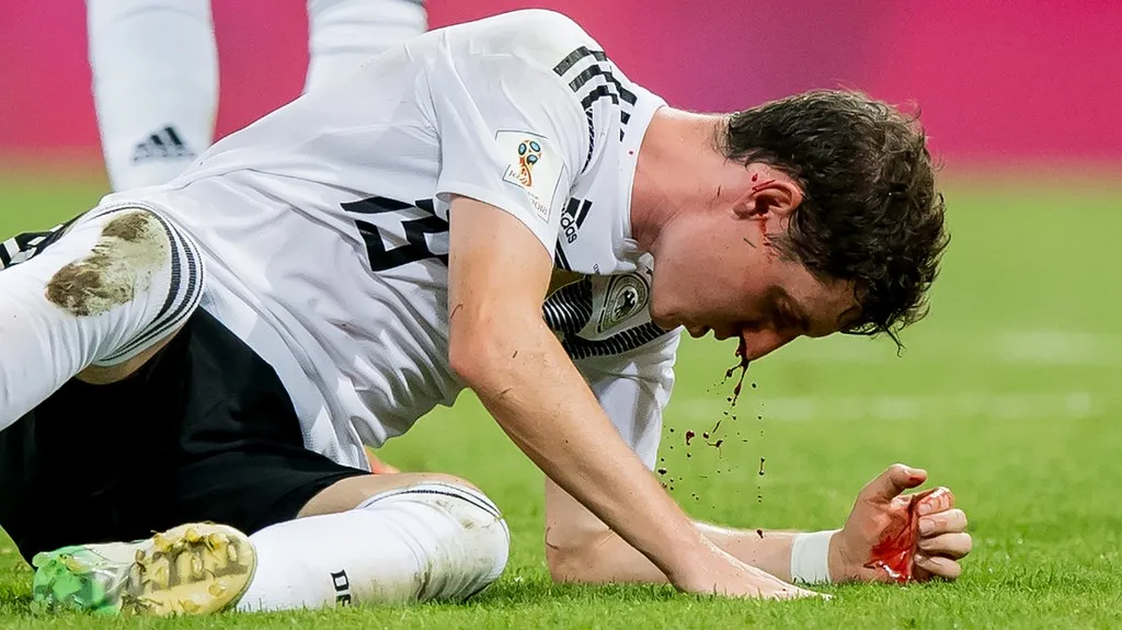 Zraněný Sebastian Rudy